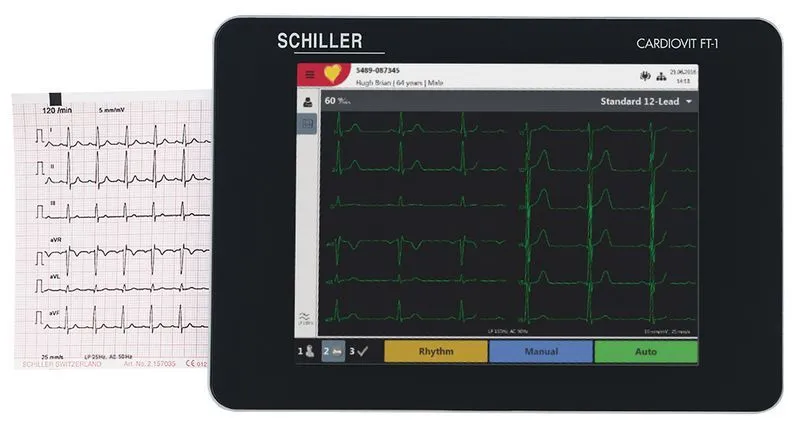 Resting ECG