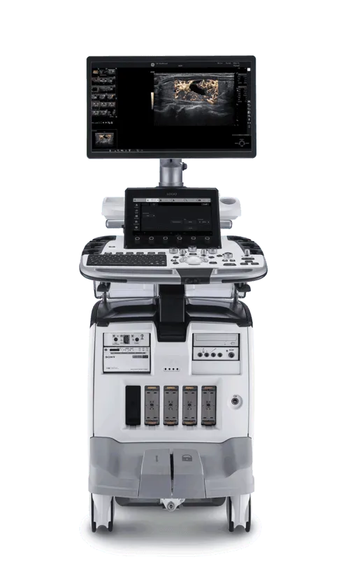 General Ultrasound