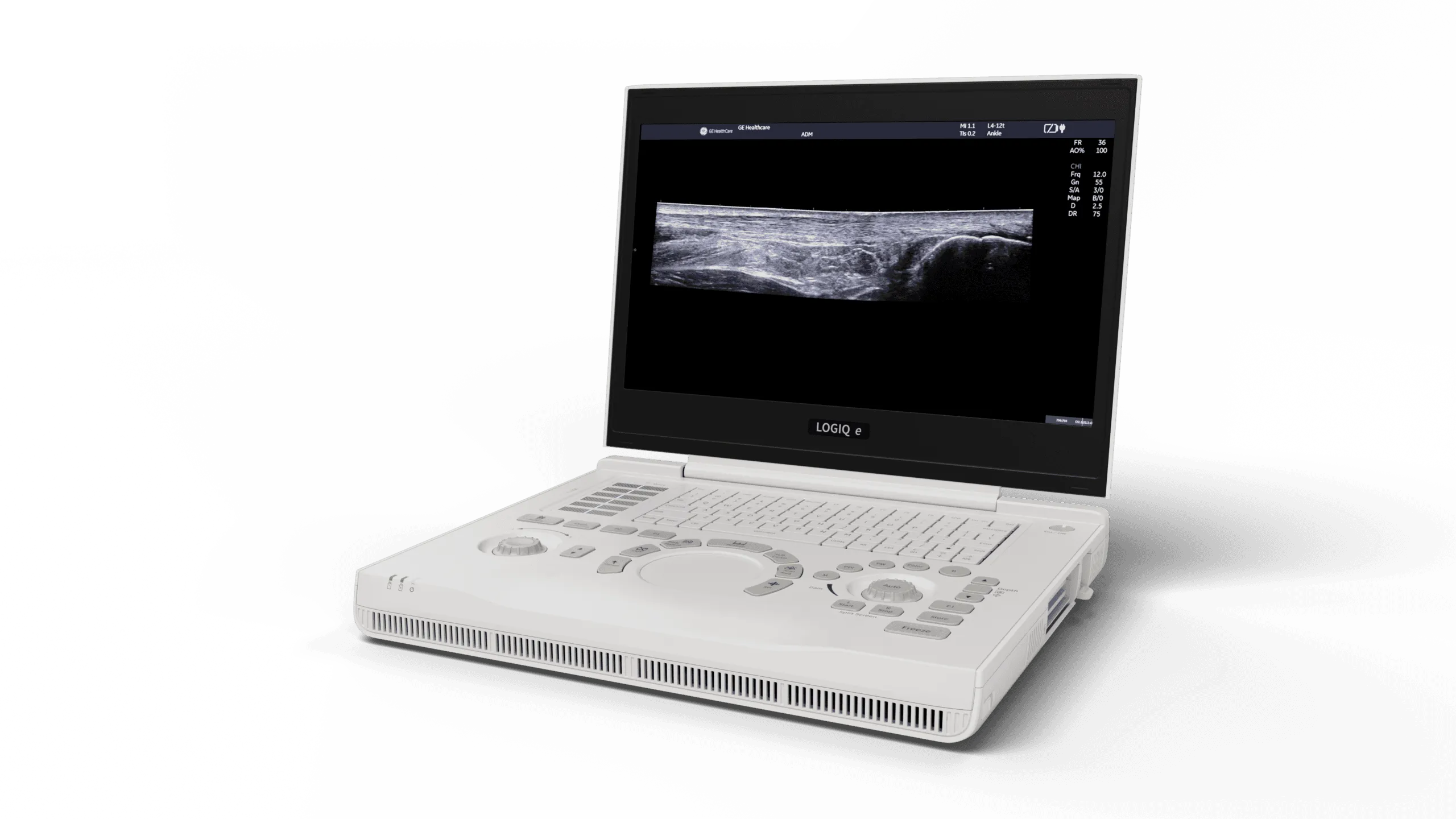 General Portable Ultrasound