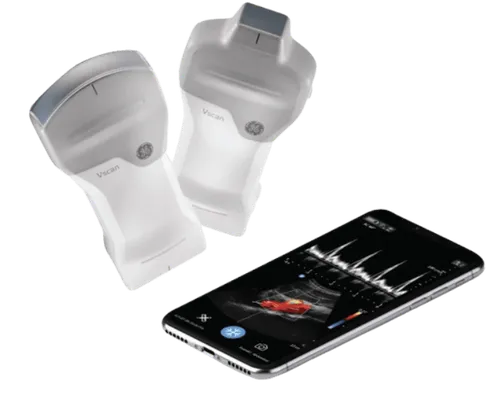 Handheld Ultrasound